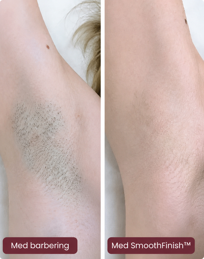 SmoothFinish™ 2-i-1 Ladyshaver – Glat Hud