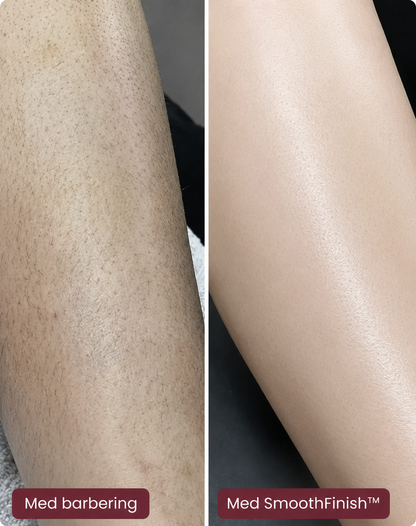 SmoothFinish™ 2-i-1 Ladyshaver – Glat Hud