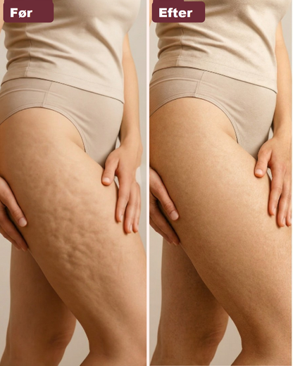 Sculpt & Smooth™ – Mindre Cellulite, Mere Selvtillid